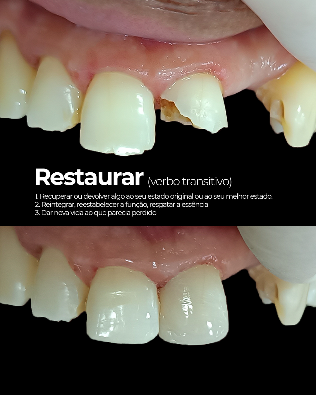 Detalhe de procedimento odontológico — VILARI Taubaté