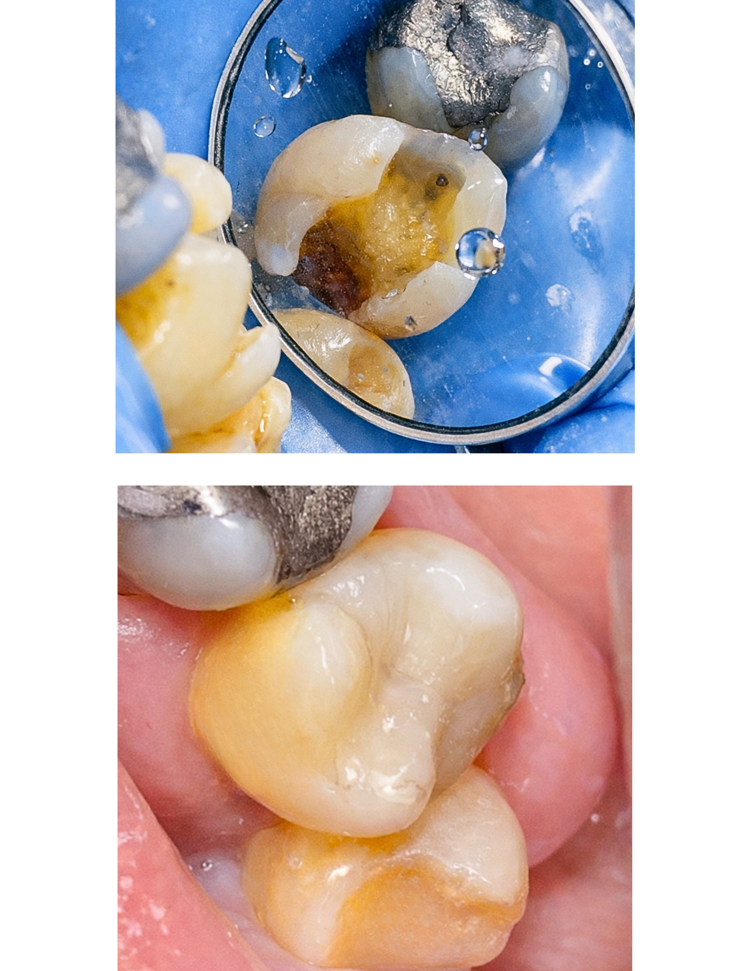 Estética dental — tratamento VILARI em Taubaté